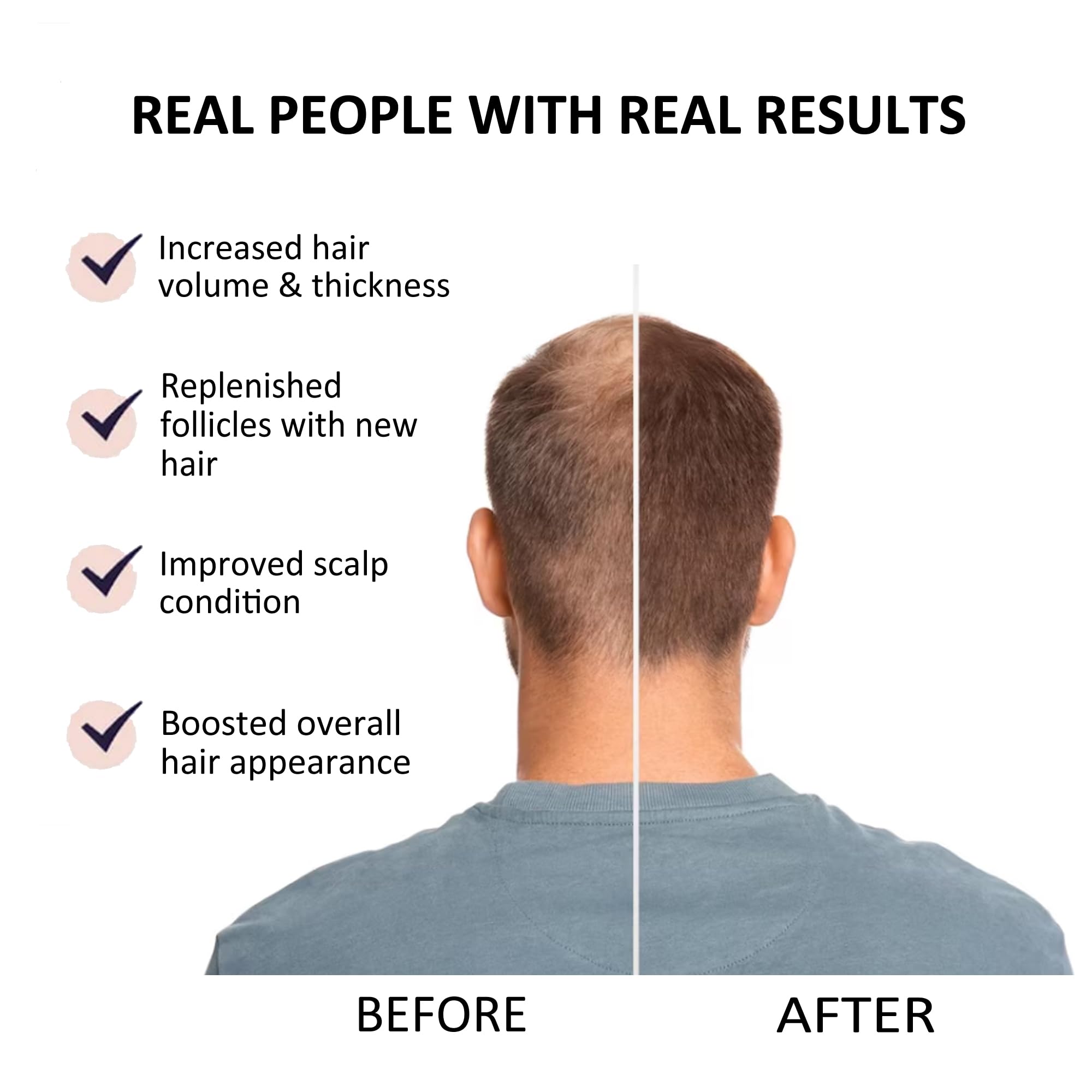 Beauty Secrets Saw Palmetto Hair Growth Serum for Women & Men - 30ml Natural Hair Loss Treatment with Redensyl, Biotin & Rosemary Oil | Stimulates Faster Growth, Reduces Hair Fall | Perfect for Thinning Hair & Scalp Care