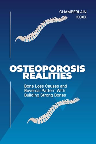 Osteoporosis Facts: Causes of Bone Loss & How to Reverse It | Build Strong Bones Naturally | Perfect for Seniors & Postmenopausal Women
