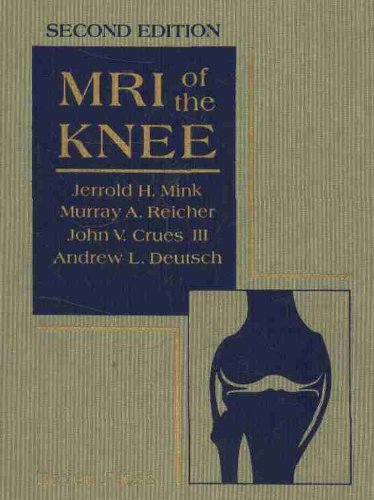 Best MRI Knee Imaging Guide - High-Resolution Knee MRI Scans for Diagnosis & Treatment | Perfect for Sports Injuries, Arthritis & Post-Surgery Evaluation