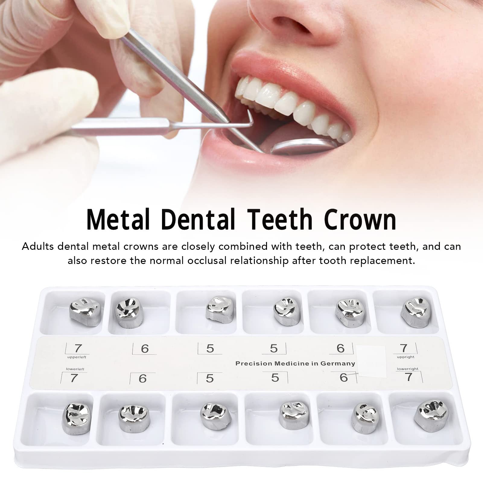Stainless Steel Dental Crowns for Teeth - Anti-Rust Metal Molar Caps for Tooth Loss Prevention | Dental Clinic & Hospital Use