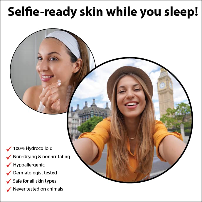 Hydrocolloid Acne Patches - 72 Count Pimple Patches for Blemishes, Zits & Breakouts | Fast-Acting Acne Treatment | Oil-Free & Gentle on Skin | Perfect for Overnight Spot Treatment & Daily Use