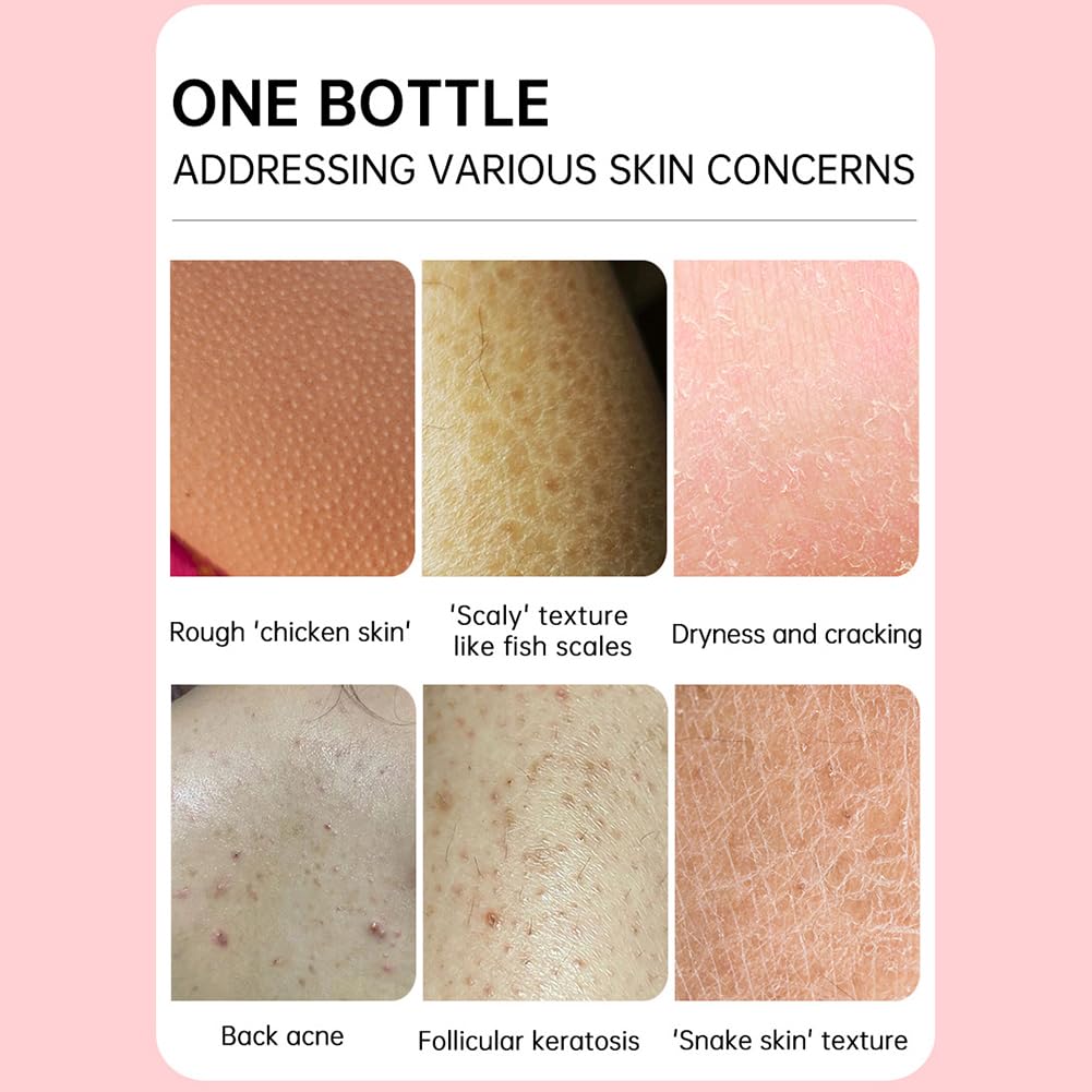 Strawberry Legs Treatment Cream for Women – 1.75 Fl Oz Bumpy Skin Body Lotion, KP Bump Eraser & Exfoliating Scrub for Keratosis Pilaris – Hydrating & Smoothing Body Care Cream for Dry, Rough Skin – Perfect for Daily Use & Post-Shaving Routine