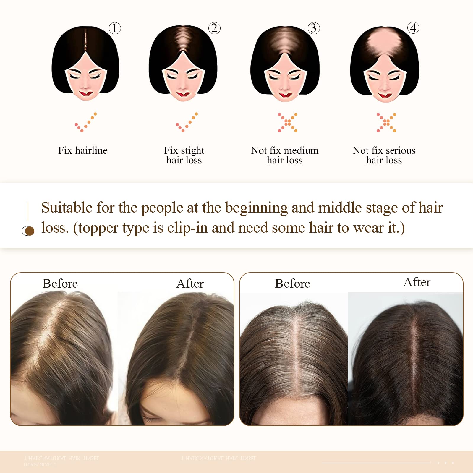 MY-LADY Clip-in Human Hair Topper for Women - 130% Density, 10x12cm Silk Base, 50g, 16 Inch, #12P613 Light Brown with Bleach Blonde Highlights - Remy Hair Top Hairpiece No Bangs - Perfect for Thinning Hair, Hair Loss, and Daily Styling