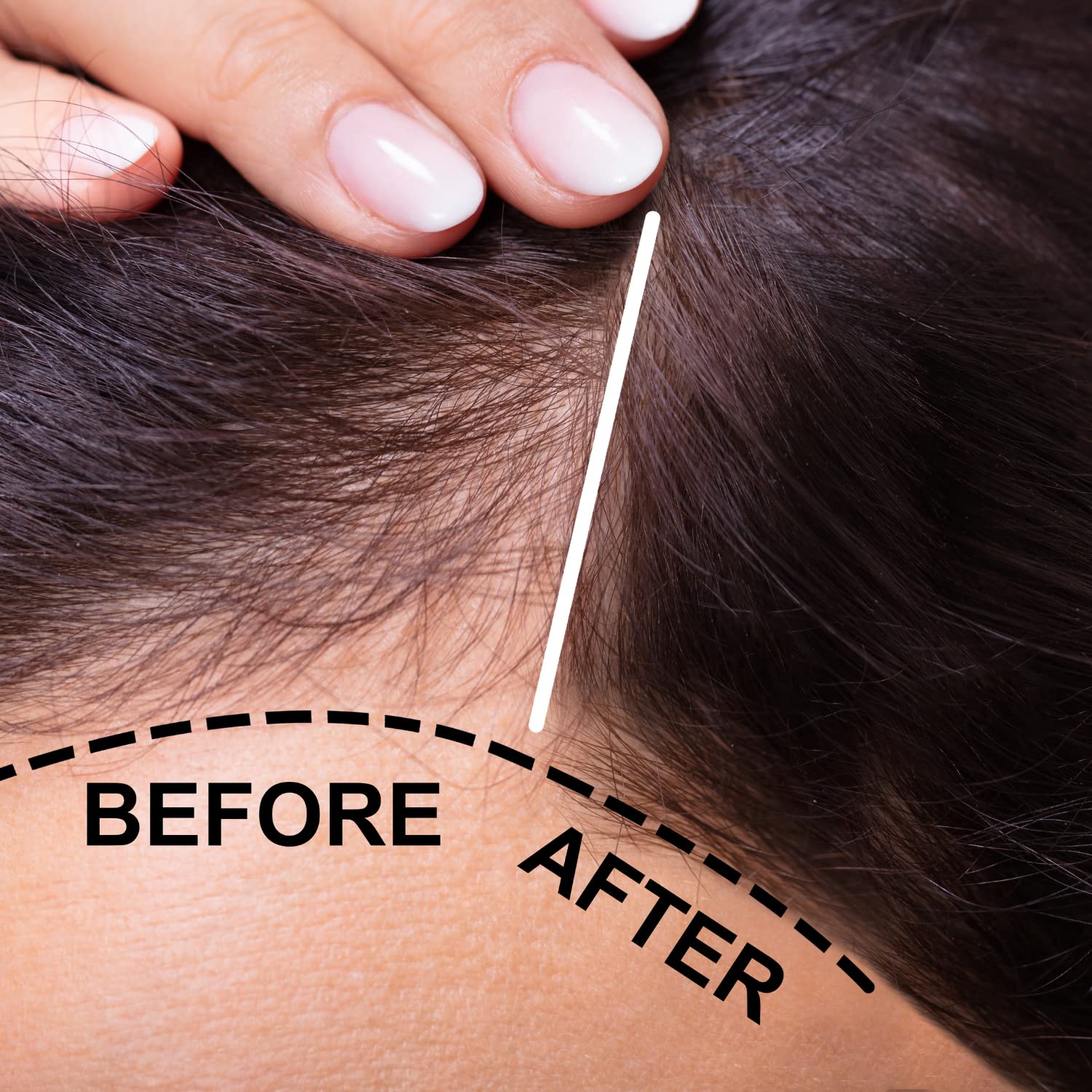 Verseo Sup Hair Growth Conditioner Treatment for Thinning Hair & Hair Loss | Repair Damaged Hair | 28 Day Supply | Perfect for Daily Use & Salon-Quality Results at Home