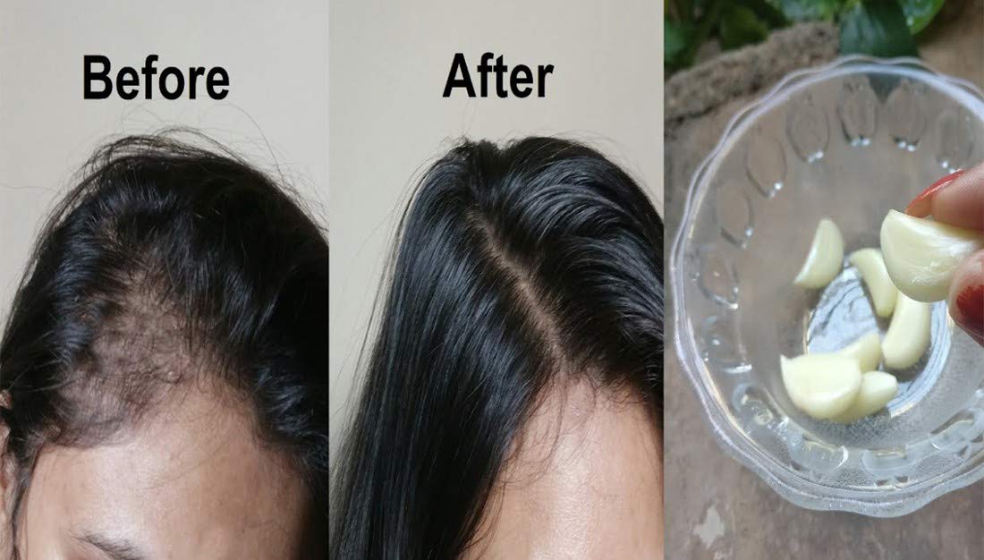 Dominaro Premium Cold Pressed Garlic Oil - 100% Pure Unrefined Hair Growth Treatment (3.4 fl oz) for Thicker, Stronger Hair - Perfect for Scalp Massage & Nighttime Hair Care Routine