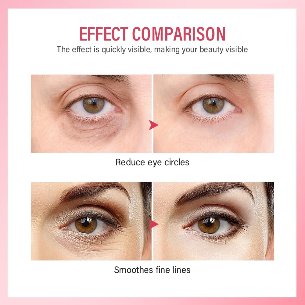 Best Retinol Eye Cream for Dark Circles & Puffiness - Anti Aging Eye Treatment with Collagen & Hyaluronic Acid - Reduces Fine Lines, Firms & Lifts Eye Area - Deep Hydration - Perfect for Nighttime Skincare Routine & Daily Under Eye Care