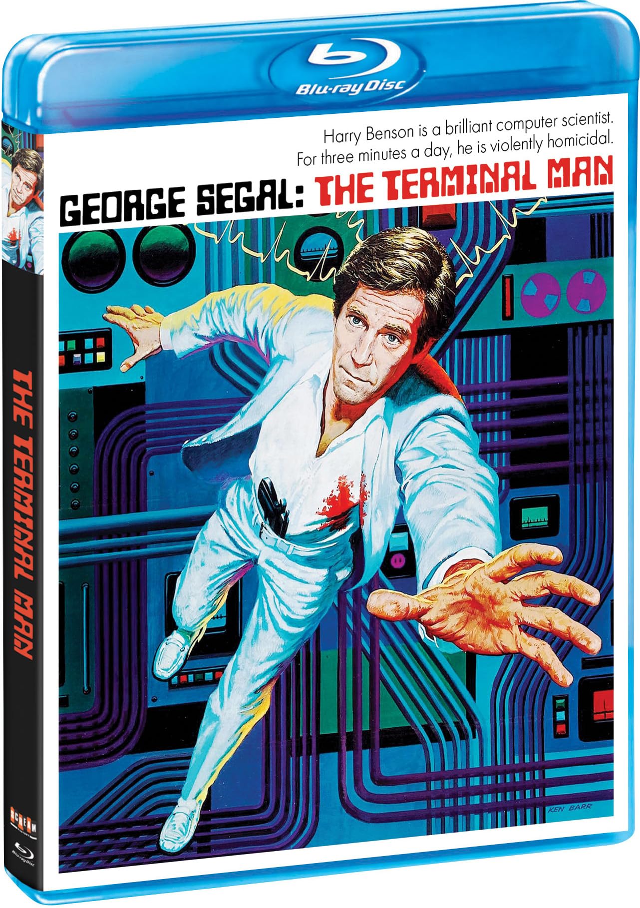 The Terminal Man Blu-ray - Classic Sci-Fi Thriller Movie for Home Theater & Movie Night Entertainment