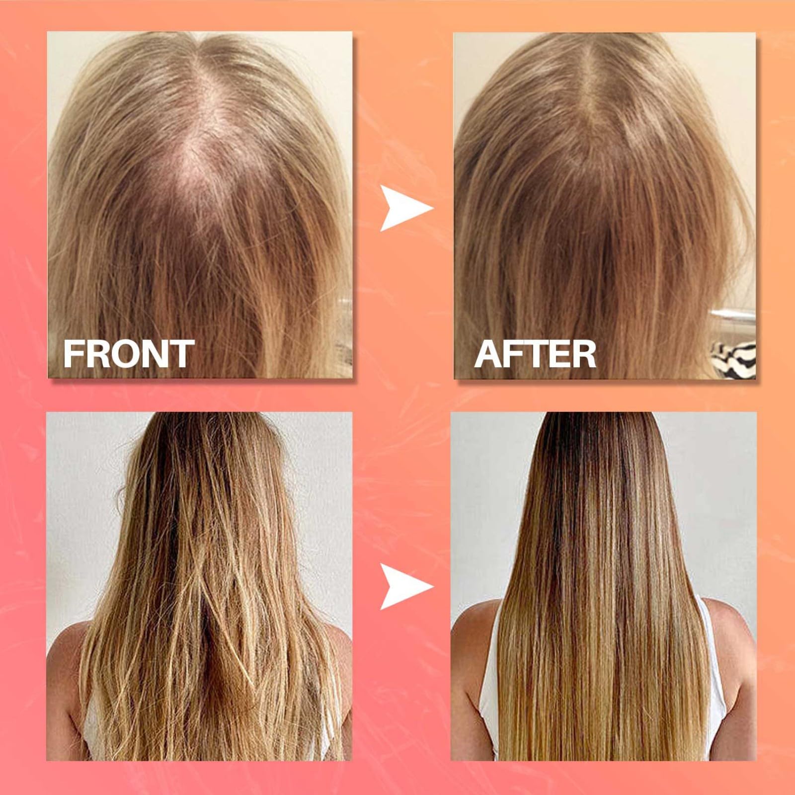 Batana Oil for Hair Growth - Leave-in Conditioner & Nourishing Treatment with Rosemary & Peppermint - Promotes Thicker, Smoother Hair - Ideal for Thinning Hair Care & Daily Scalp Treatment