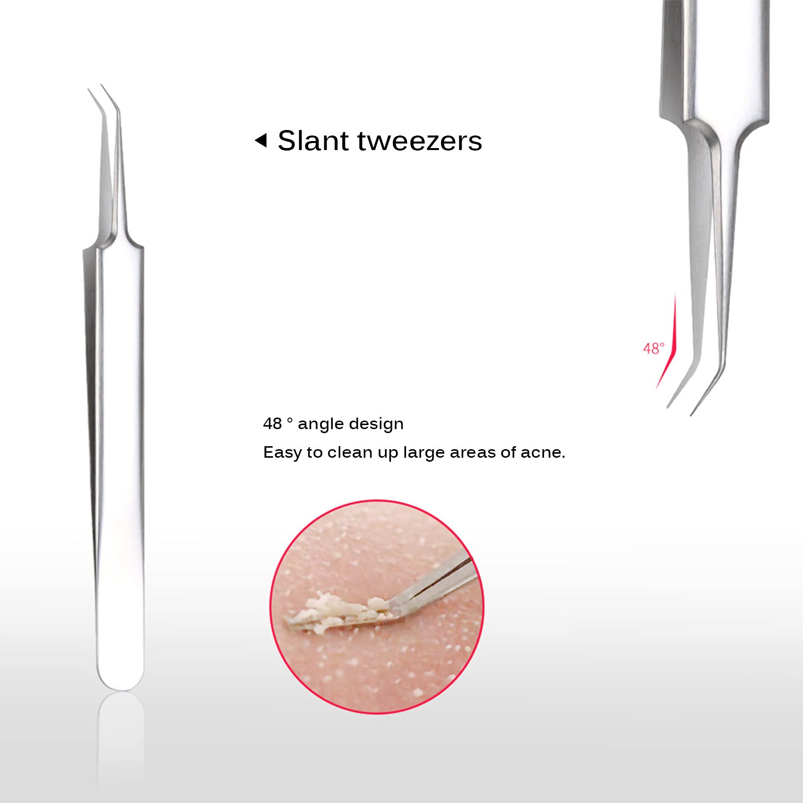 Ankeer 4Pcs Blackhead Remover Kit - Acne Comedone Pimple Extractor Tool Set with Storage Case for Facial Skin Care, Blackhead Tweezers & Blemish Cleaner - Perfect for Home Spa & Professional Use