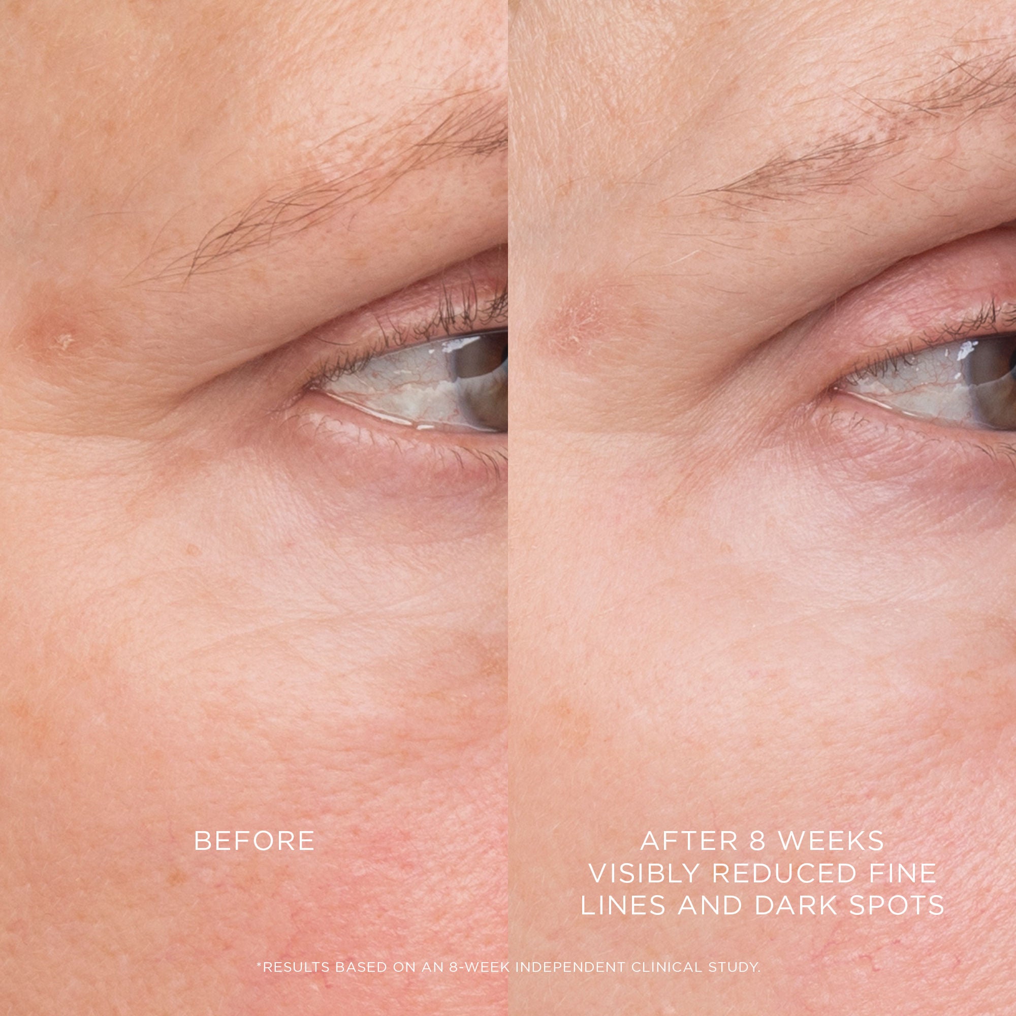 Equilibrium Resurfacing Retinoid Treatment - Anti-Aging Face Serum for Wrinkles & Fine Lines | Perfect for Nighttime Skincare Routine