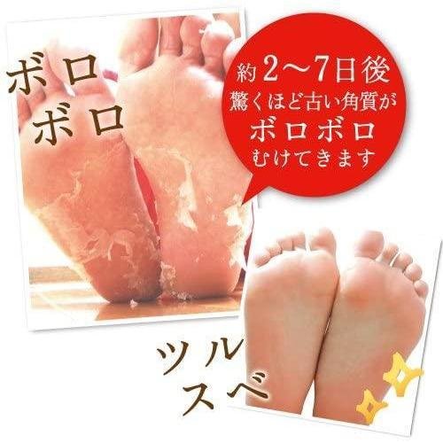 Liberta Baby Foot Exfoliation Foot Peel - 30 Minutes Treatment for Soft Smooth Feet - Size S - Perfect for Pedicures, Spa Days & At-Home Foot Care