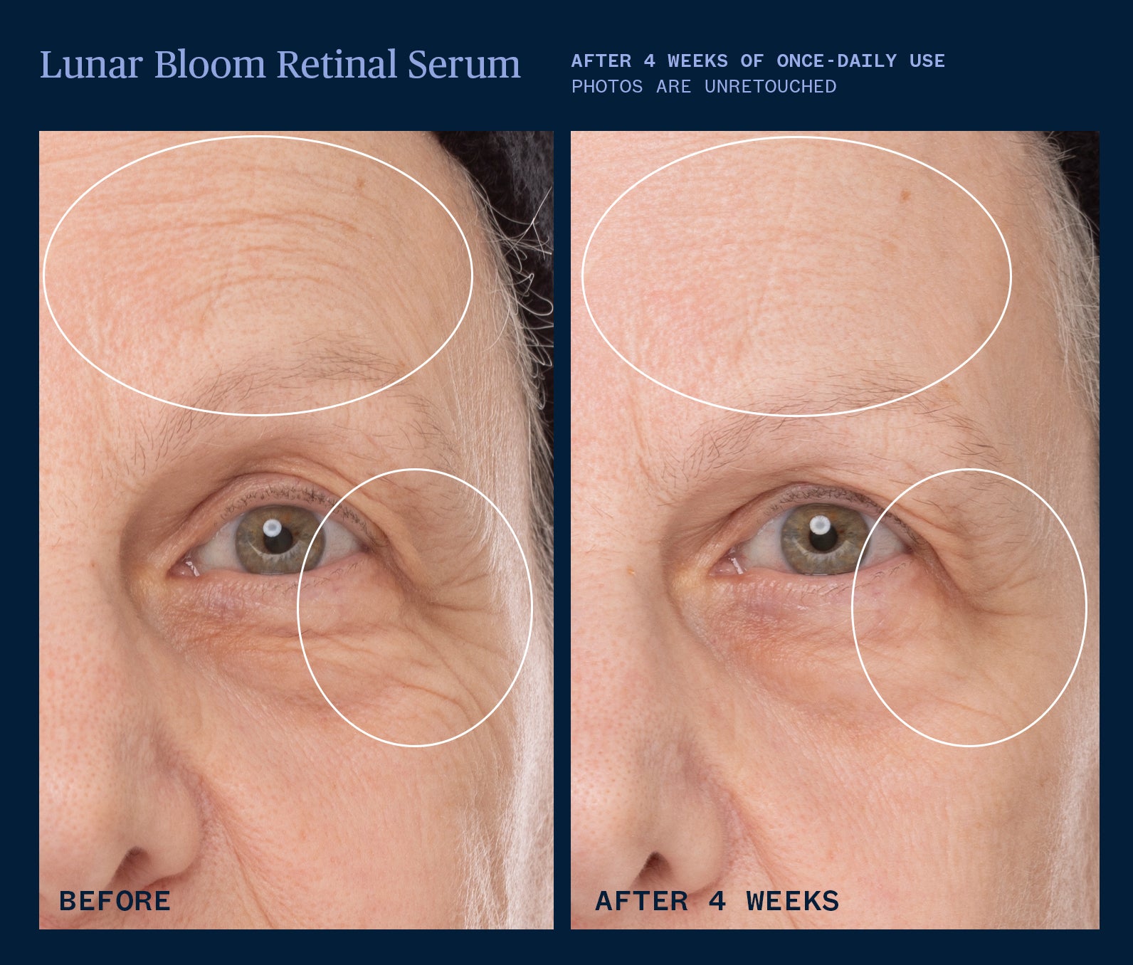 Lunar Bloom Retinal Serum for Wrinkles & Anti-Aging | Dark Spot Corrector & Night Repair Treatment | Perfect for Dry, Sensitive Skin & Evening Skincare Routine