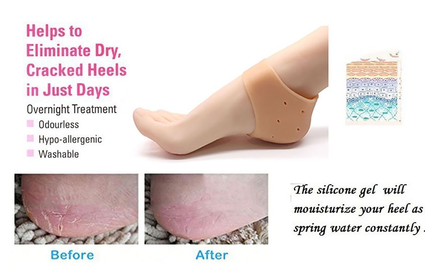 Brezzycloud Silicone Gel Heel Pad Socks for Heel Swelling & Pain Relief, Dry Cracked Heels Repair Cream, Foot Care & Ankle Support Cushion - Men & Women (2 Pairs) - Perfect for Running, Hiking & Daily Comfort