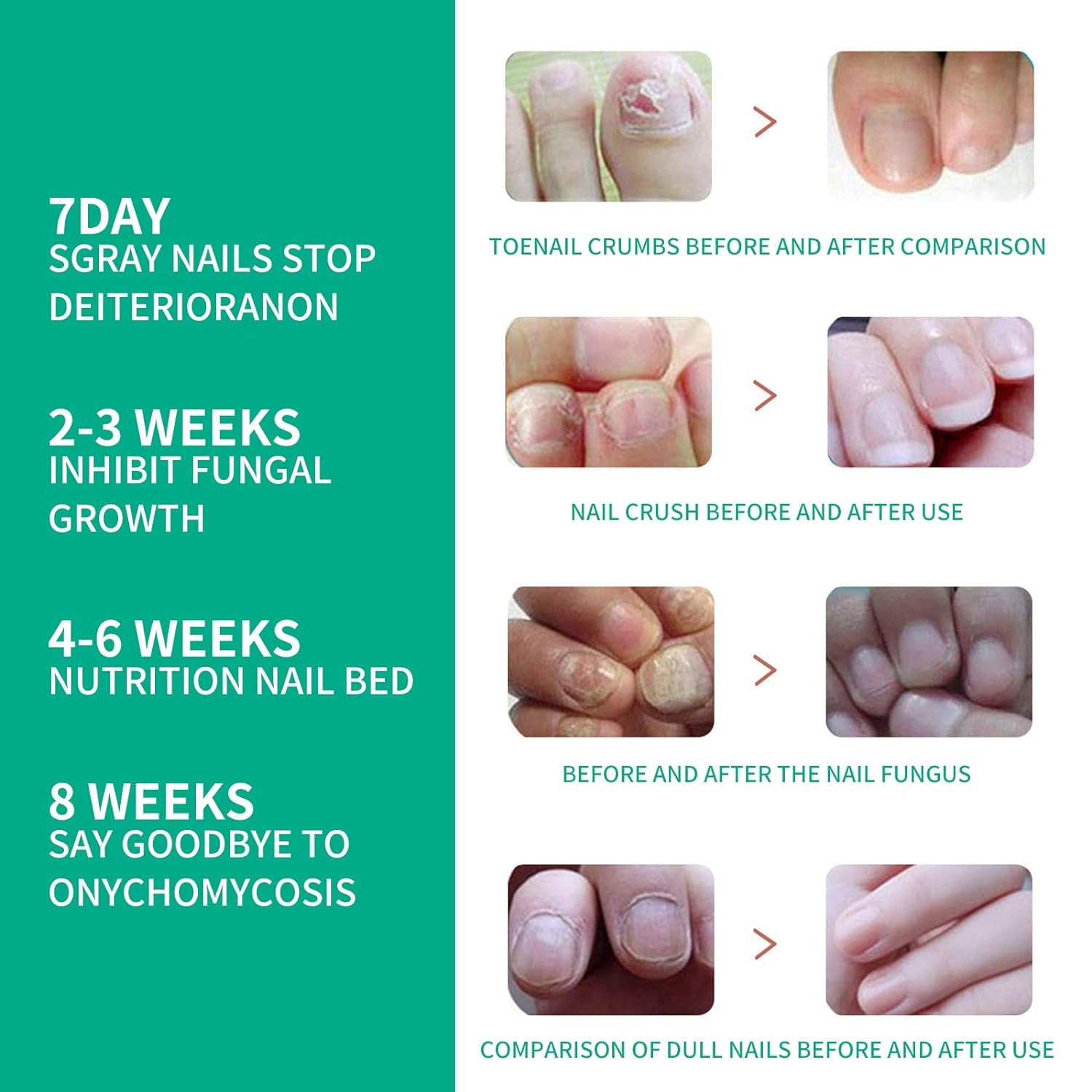 Extra Strength Toenail Fungus Treatment for Toenails & Fingernails | Fast-Acting Nail Repair Solution | Renewal Liquid for Damaged & Discolored Nails (2oz) | Effective for Athlete's Foot & Nail Fungus | Home & Travel Use