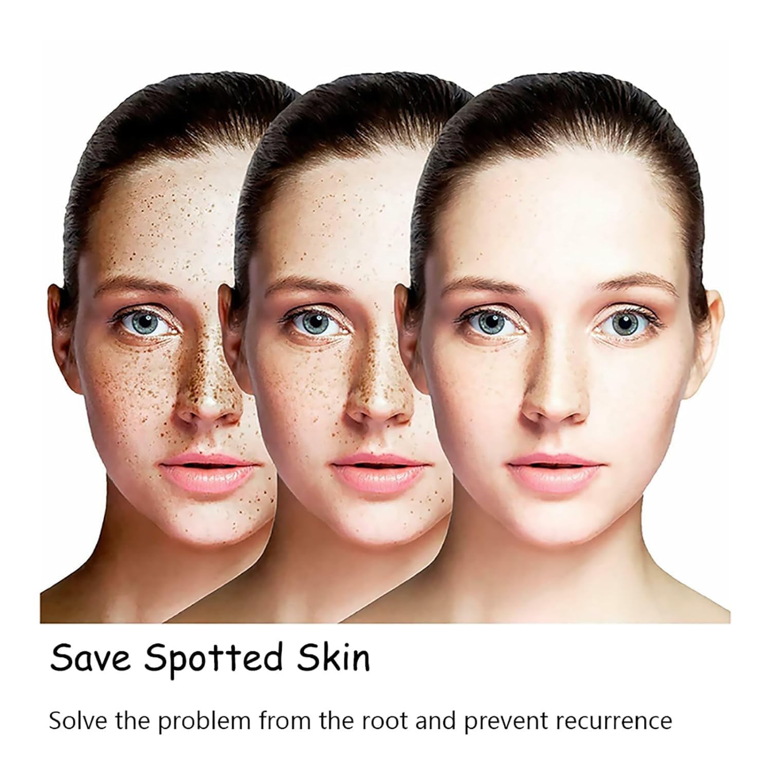 30ml Vitamin C Brightening Serum for Dark Spots & Hyperpigmentation – Anti-Aging Face Serum with Essence Removal (2 Pack) – Perfect for Daily Skincare Routine & Nighttime Treatment