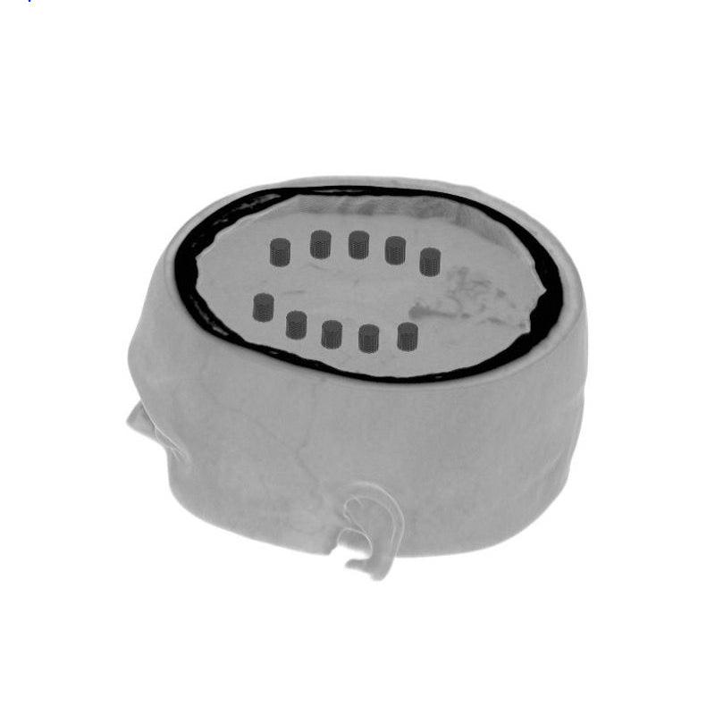 CTA AVM / Lesion Head Phantom - High-Quality CT Scan & X-Ray Training Tool for Medical Students & Radiology Professionals | Perfect for Diagnostic Imaging Practice & Medical Education
