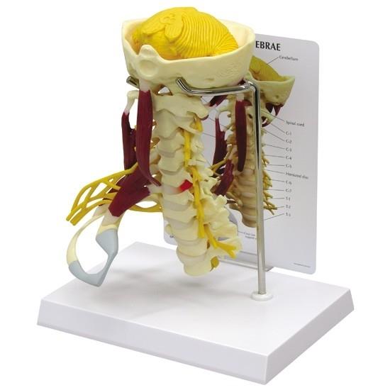 Premium Human Cervical Spine Model with Muscles - Detailed Anatomical Study Tool for Medical Students & Chiropractors - Perfect for Classroom, Clinic & Patient Education