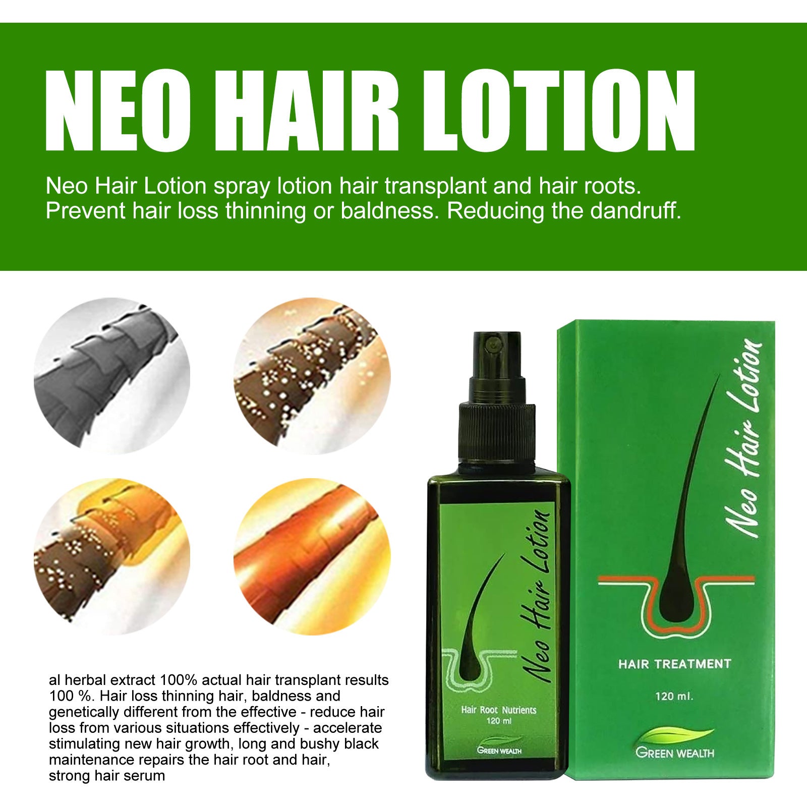 Hair Growth Lotion Spray for Thicker, Longer Hair - Nourishing Treatment for Hair Loss Prevention & Scalp Care - Perfect for Daily Use at Home or Salon