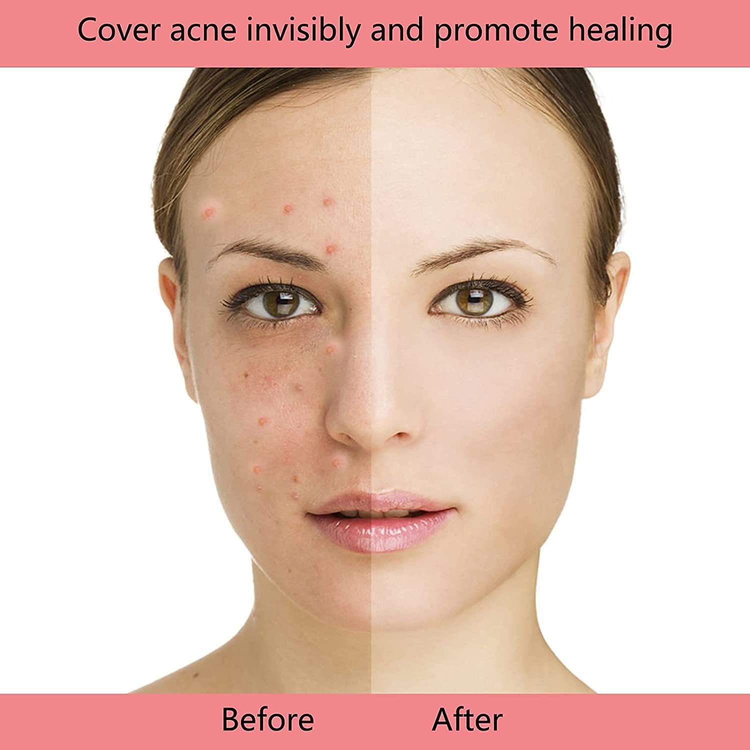 Hydrocolloid Acne Pimple Patches - Ultra-Thin 0.05mm Invisible Spot Treatment for Face & Body - 72 Count (3 Sizes) - Breathable Blemish Cover for Day & Night Use - Perfect for School, Work, and Travel