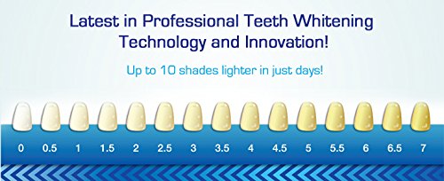 Sparkling White Smiles Professional Teeth Whitening Kit - At Home Whitening System Brightens Up to 6 Shades in 2 Days | Safe, Easy to Use & Mess-Free | Gentle Yet Effective for Whiter Teeth | Perfect for Weddings, Job Interviews & Special Occasions