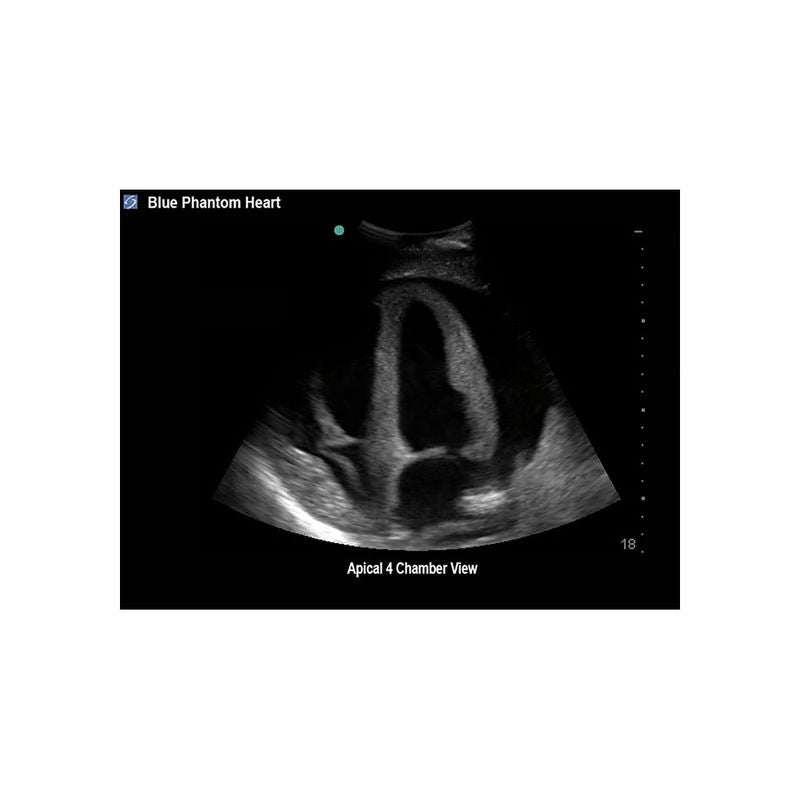 FAST Exam Ultrasound Training Model - Transthoracic & Transesophageal Echo Simulator for Cardiac Sonography Practice (Ideal for Medical Students, Ultrasound Tech Training & Clinical Skills Development)
