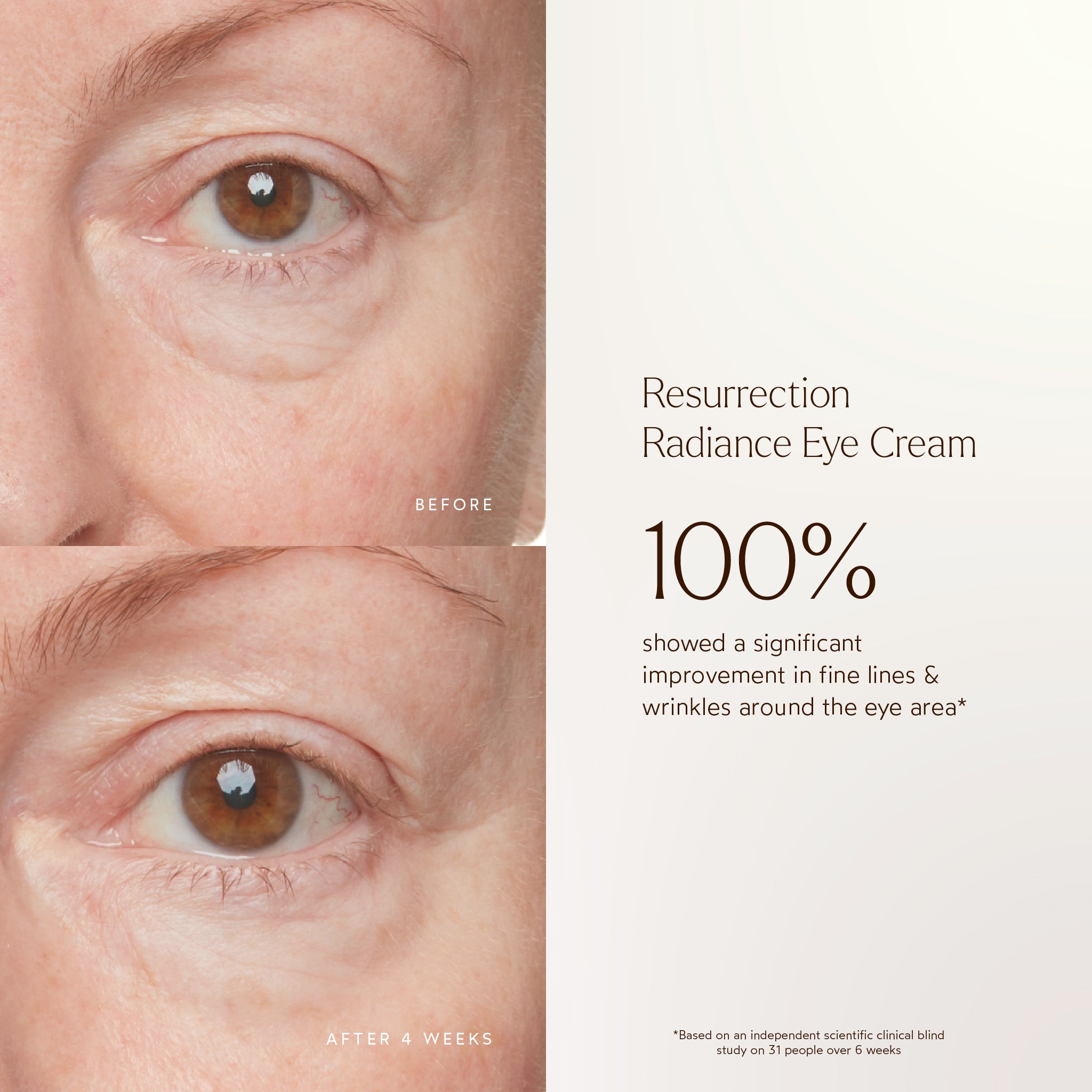 Resurrection Radiance Anti-Aging Eye Cream for Dark Circles & Wrinkles - Hydrating & Firming Under Eye Treatment for Women & Men - Perfect for Night Routine & Travel Skincare