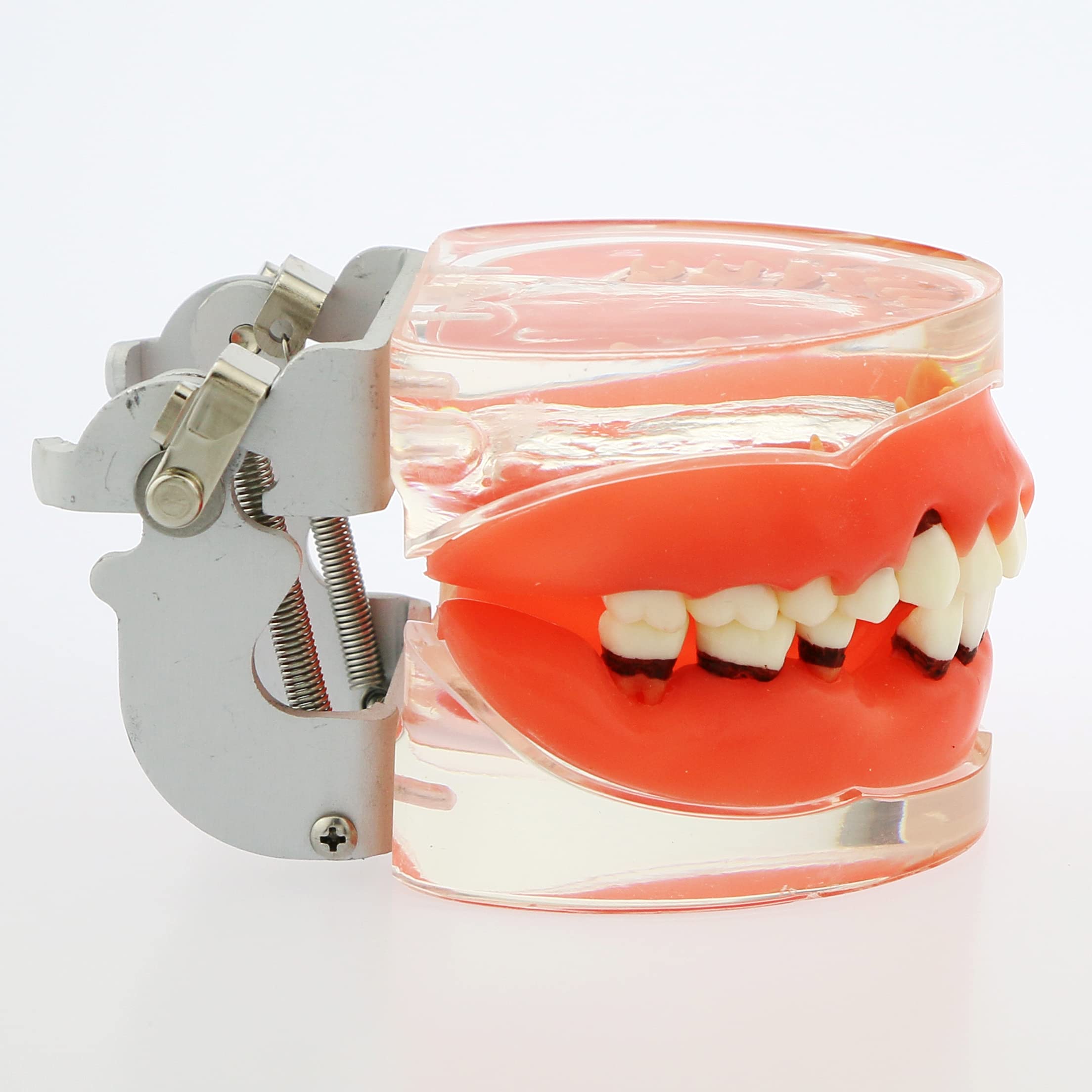 Adult Transparent Dental Teeth Model - Removable Gingivae for Pathology Study & Teaching - Perfect for Dental Students, Dentists & Medical Professionals