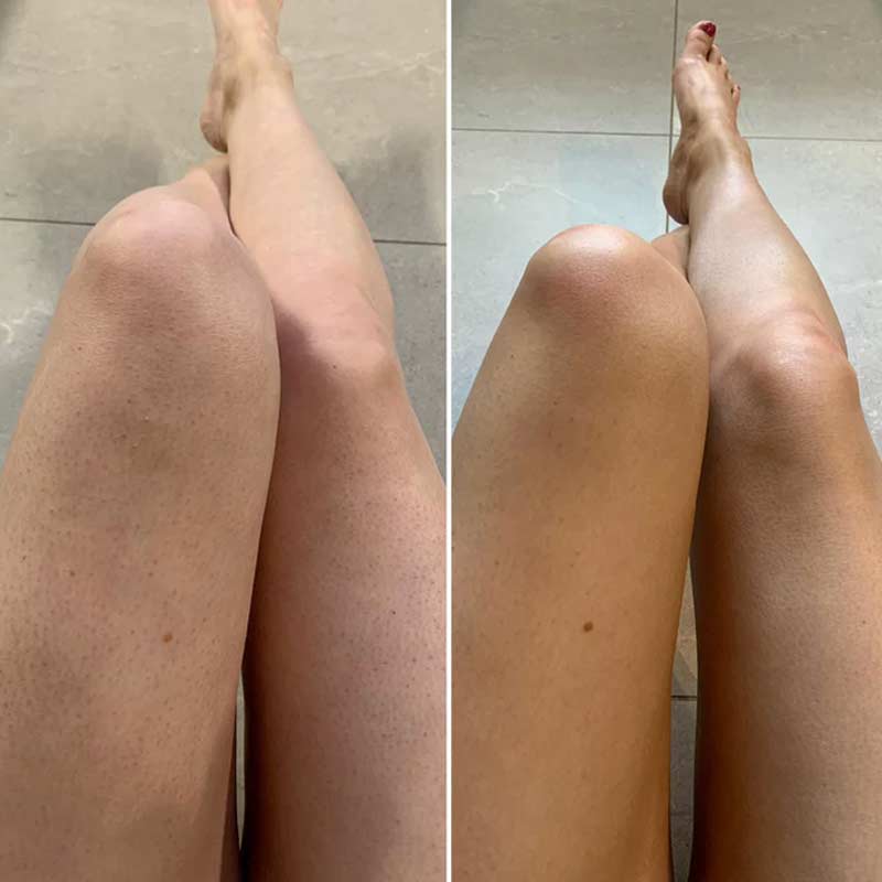 Beauti Edit Self Tanning Foam - Natural Looking Sunless Tan for Face & Body | Easy Application, Streak-Free Glow | Perfect for Beach, Vacation & Special Occasions