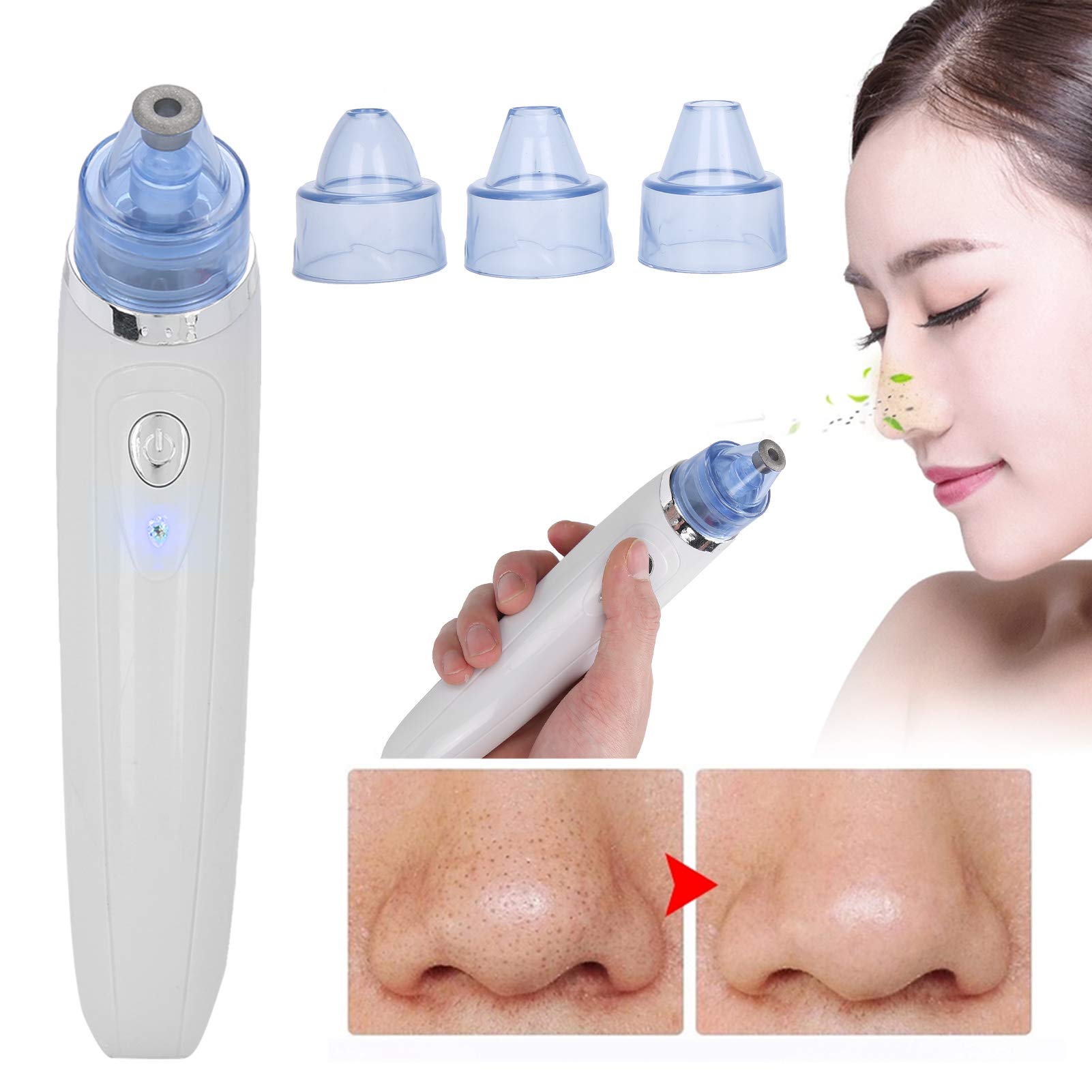 Blackhead Remover Vacuum with 4 Probes - 3 Adjustable Suction Levels for Deep Pore Cleansing at Home
