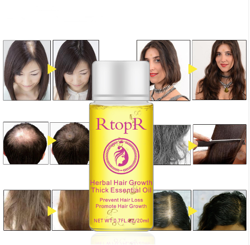 Fast Powerful Hair Growth Essential Oil Treatment - 20ml Liquid for Preventing Hair Loss & Stimulating Growth | Natural Hair Care Solution for Thinning Hair & Scalp Health | Perfect for Daily Use & Hair Regrowth Routine