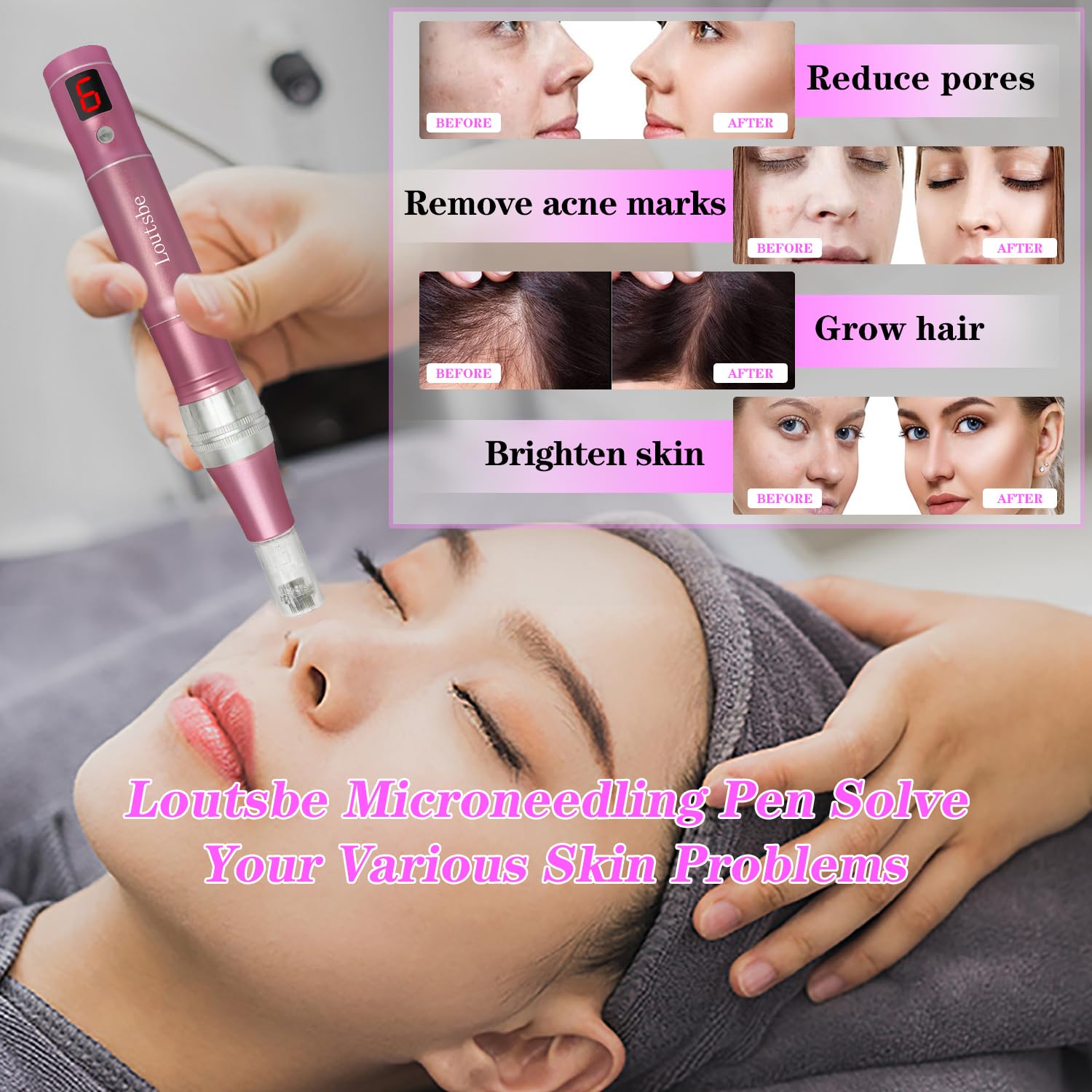 Professional Cordless Electric Microneedling Pen 28000RPM - Home Use Derma Roller with 30 Replacement Cartridges (12/36/Nano Needles) for Skin Rejuvenation & Anti-Aging | Perfect for At-Home Facial Treatments & Beauty Care