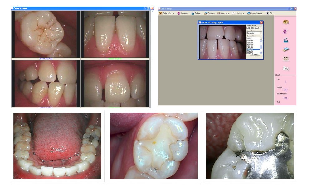 MD740 Dental Intraoral Camera with USB Connection - 6 LED Lights & 1.3MP HD Imaging - Includes Dental Software for Oral Examinations & Patient Education
