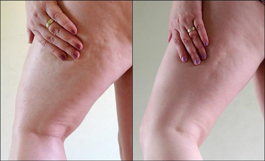Best Cellulite Gel for Thighs - 33.9 Oz Firming & Tightening Cream - Reduce Dimples & Improve Skin Texture | Perfect for Post-Workout Recovery & Summer Body Prep