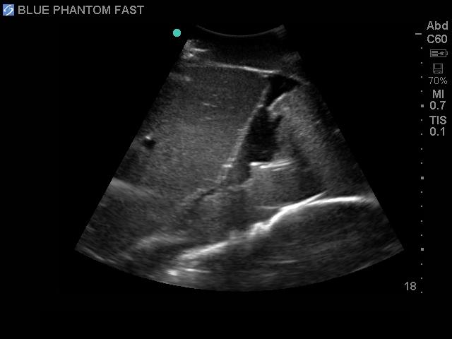 FAST Exam Real Time Ultrasound Training Model - Transthoracic Only for Emergency Medicine & Trauma Assessment Practice (Medical Simulation, Sonography Education, TTE Training)