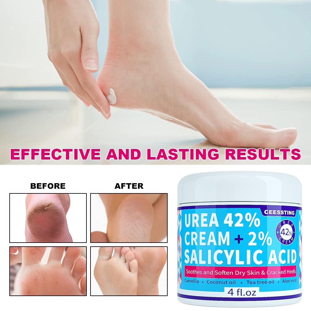 42% Urea Foot Cream with 2% Salicylic Acid & Hyaluronic Acid - Deep Moisturizing Treatment for Dry Cracked Feet, Hands, Heels, Elbows & Knees - 4 oz - Perfect for Callus Removal & Skin Repair at Home or Salon