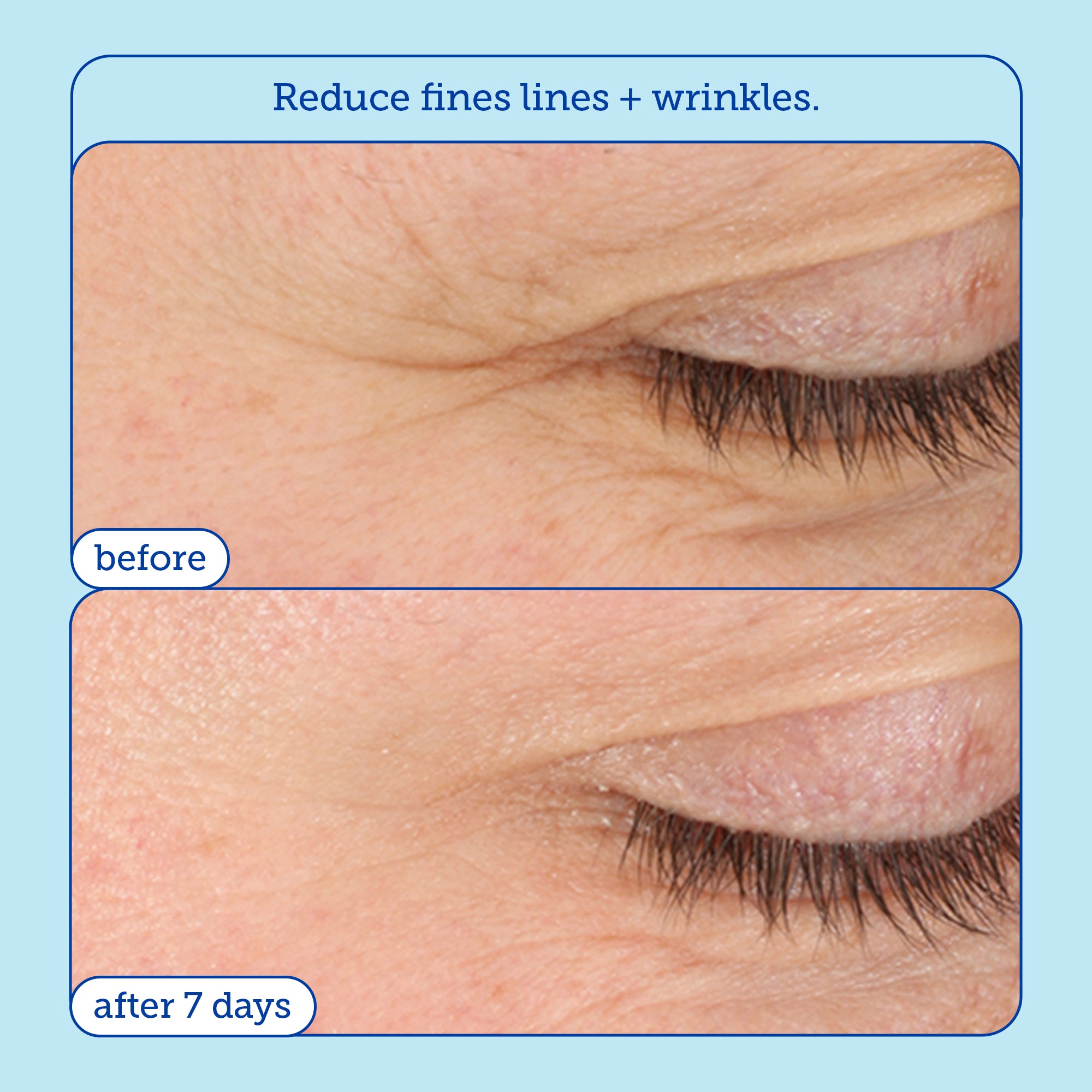 Barrier+ Triple Lipid Boost 360° Eye Cream - Anti-Aging Eye Treatment for Dark Circles, Wrinkles & Puffiness - Hydrating & Firming Eye Care for Day & Night Use - Perfect for Sensitive Skin & Travel Skincare Routine
