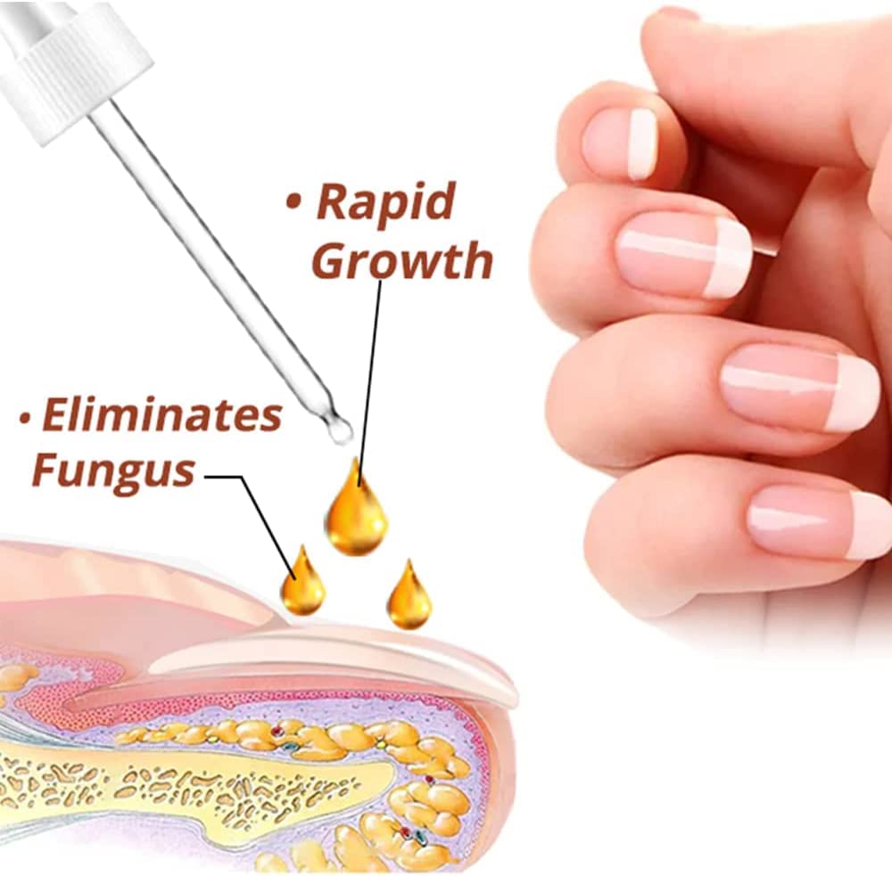 GFOUK 7 Days Nail Growth & Strengthening Serum - 20ml Fast-Acting Nail Repair Oil for Stronger, Healthier Nails - Natural Toenail Treatment for Damaged & Brittle Nails (3-Pack) - Perfect for Salon Use & At-Home Nail Care