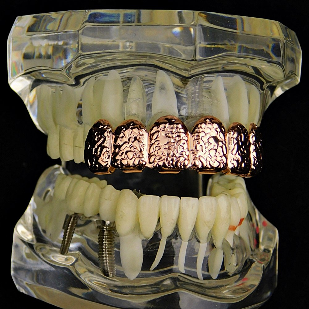 14K Rose Gold Plated Hip Hop Grillz - 6 Piece Upper Teeth Slugs for Men & Women | Perfect for Rappers, Performers & Hip Hop Fashion Enthusiasts