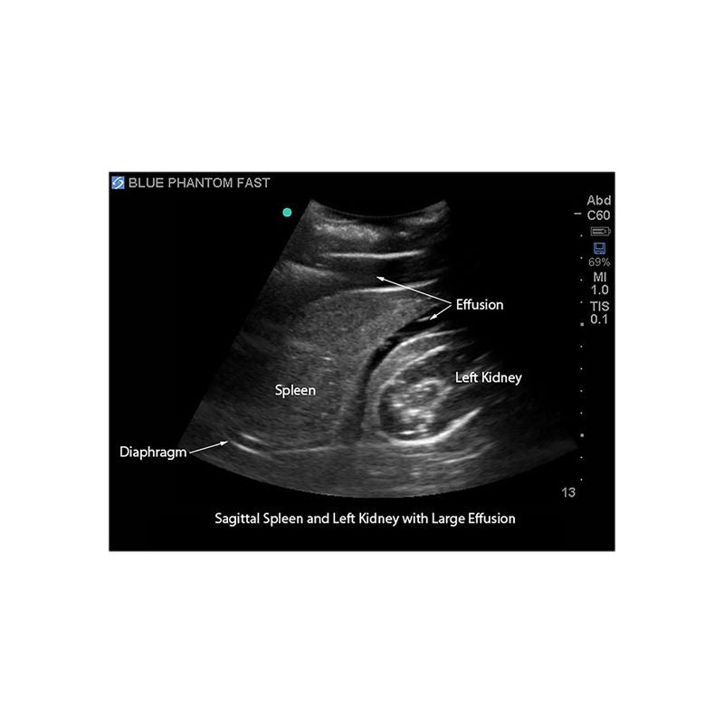 FAST Exam Ultrasound Training Model - Transthoracic & Transesophageal Echo Simulator for Cardiac Sonography Practice (Ideal for Medical Students, Ultrasound Tech Training & Clinical Skills Development)