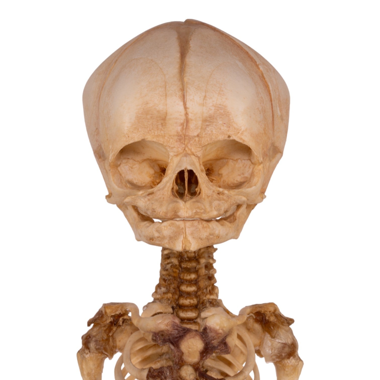 Premium Human Fetal Articulated Skeleton Model with Stand - Medical Education, Anatomy Study & Research Tool for Students and Professionals