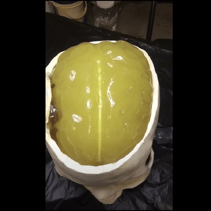 Hematoma Adult Head Phantom for X-Ray, CT, Ultrasound & MRI Training - Medical Imaging Practice for Radiology Students and Professionals