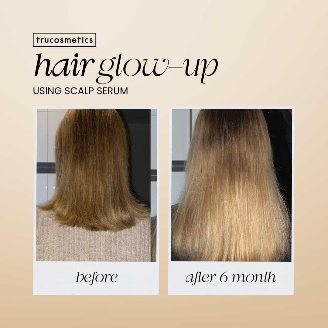 Trucosmetics Hair Growth Serum - Reduce Hair Loss & Boost Growth for Healthy, Full Hair | Scalp Treatment for Thicker Hair | 50ml | Perfect for Daily Use & Hair Care Routine