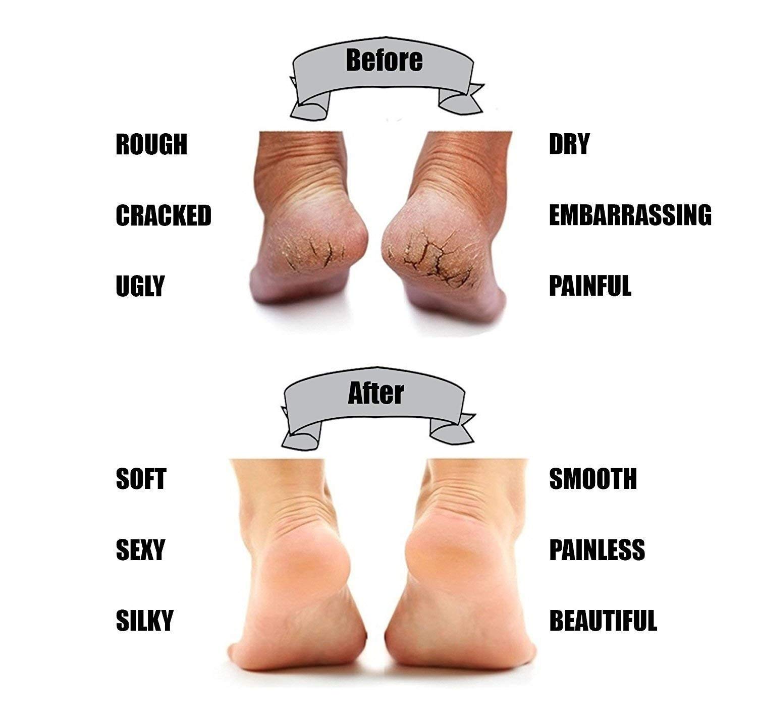 Nirvik Gel Heel Socks for Swollen Feet & Pain Relief - Moisturizing Cracked Heel Repair Cream - Unisex Foot Care & Ankle Support Gel Pads - Perfect for Daily Comfort, Running & Post-Surgery Recovery