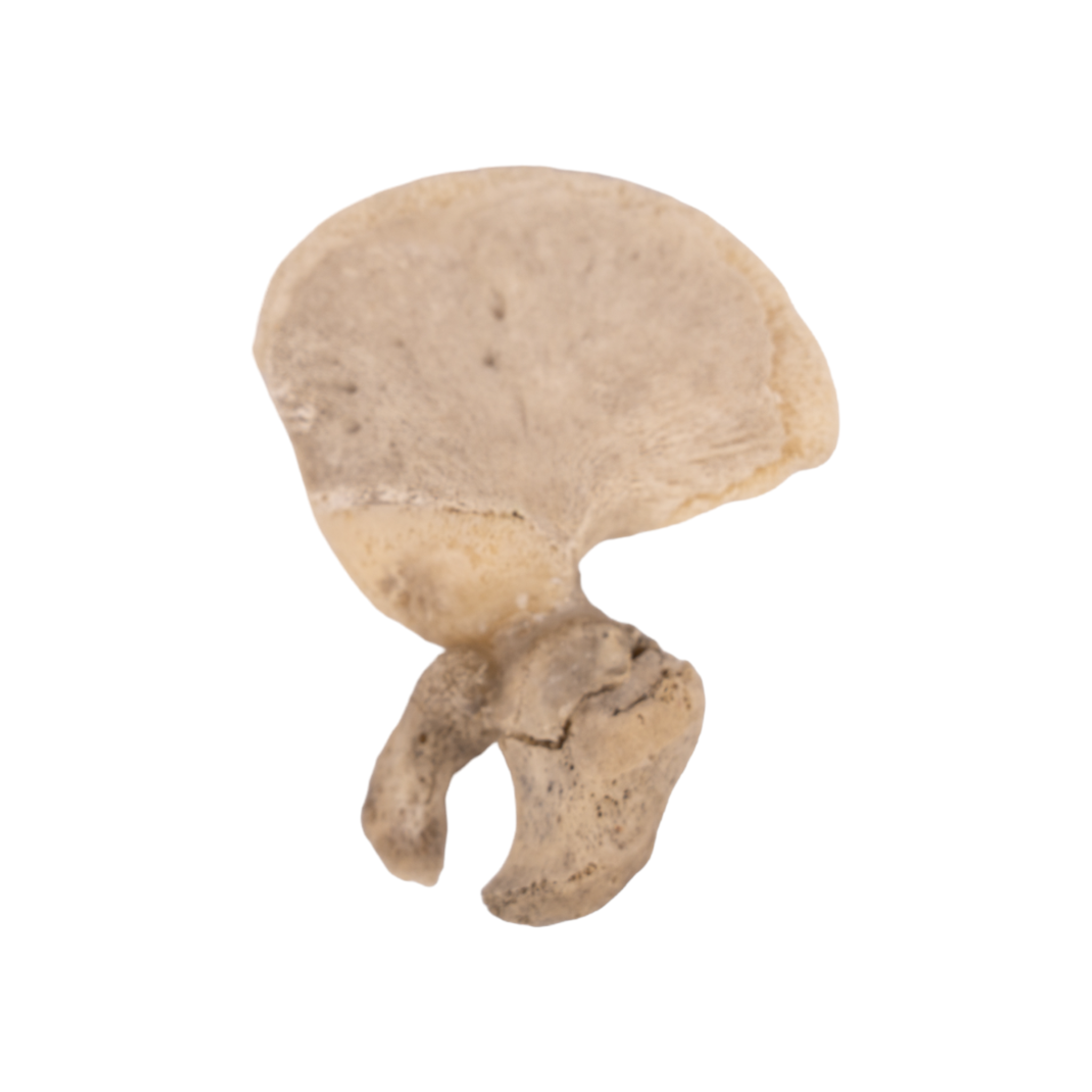 Premium Human Fetal Ilium for Medical Research - High-Quality Anatomical Specimen for Pathology Studies, Medical Education & Scientific Research