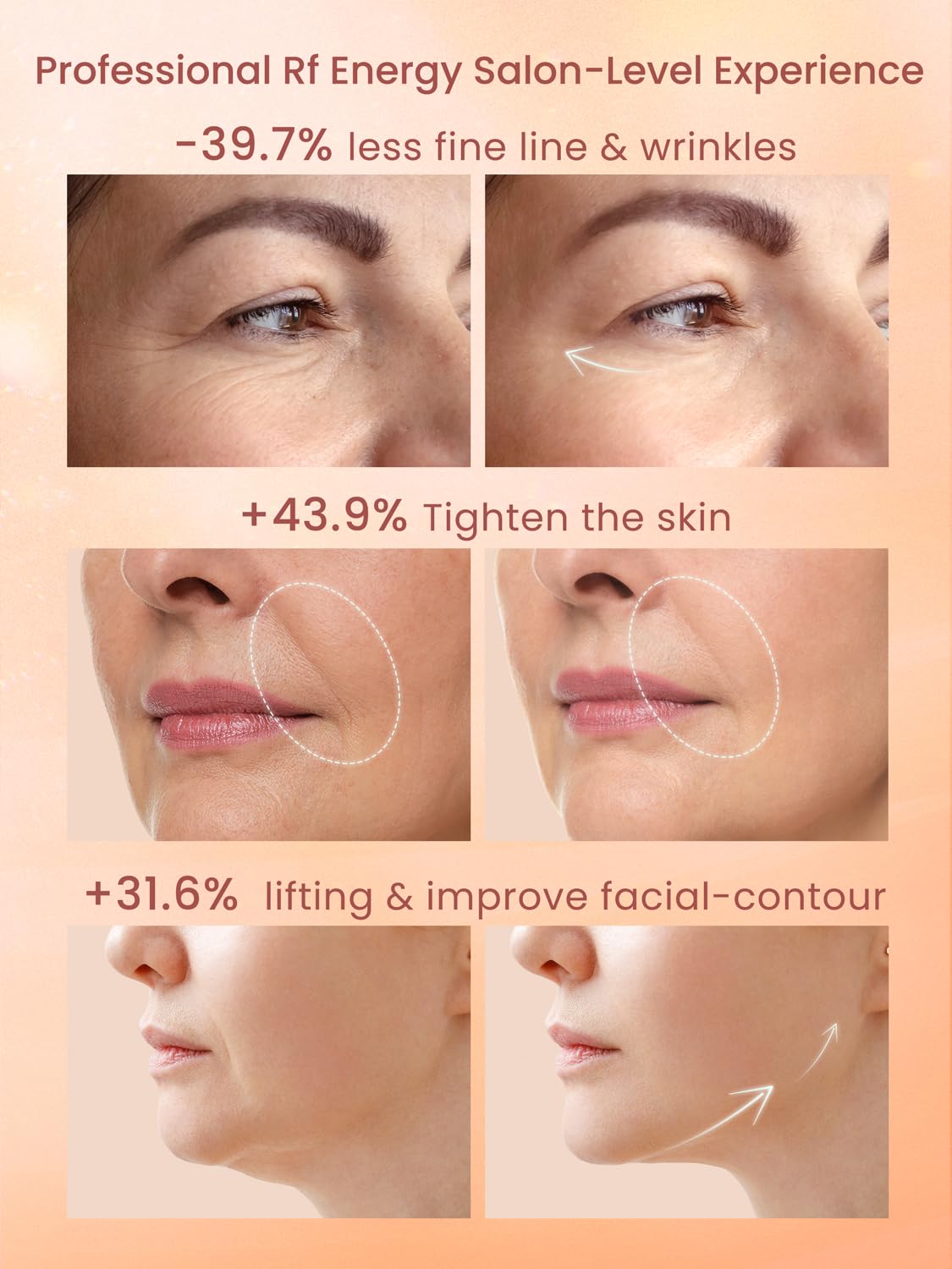 RF Skin Tightening Device for Face - Anti-Aging Wrinkle Removal & Lifting Machine, Wireless Home Beauty Device with 3 Levels for At-Home Skin Renewal | Perfect for Daily Skincare Routine, Salon-Quality Facial Treatment & Anti-Aging Care