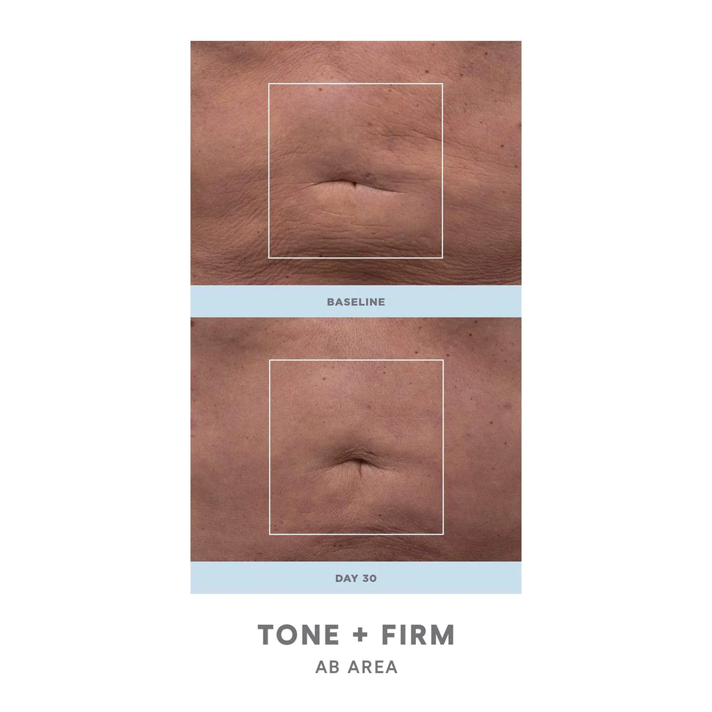 NuFACE NuBODY Body Toning Device - Professional Skin Tightening & Contouring for Arms, Legs & Abs | At-Home Body Sculpting & Anti-Aging Treatment