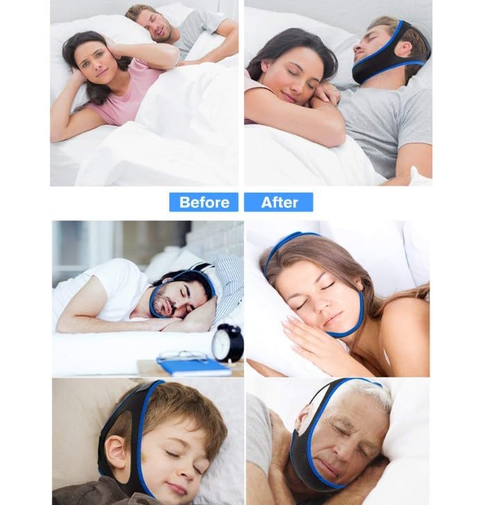 Veralabs Airflow Jaw Strap - Adjustable & Breathable Snoring Chin Strap for Men & Women - Stop Snoring & Improve Sleep - Comfortable for Side & Back Sleepers (Blue)