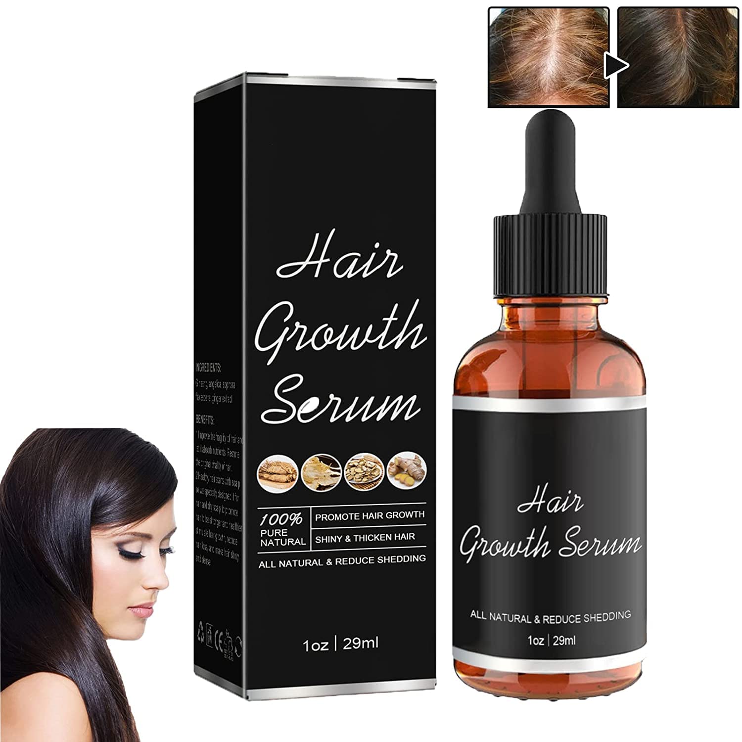 Allurium Hair Growth Serum 2023 - Anti Hair Loss Treatment for Dry & Damaged Hair Repair - Nourishing Formula for All Hair Types - Perfect for Daily Use & Hair Regrowth Therapy (1PC)
