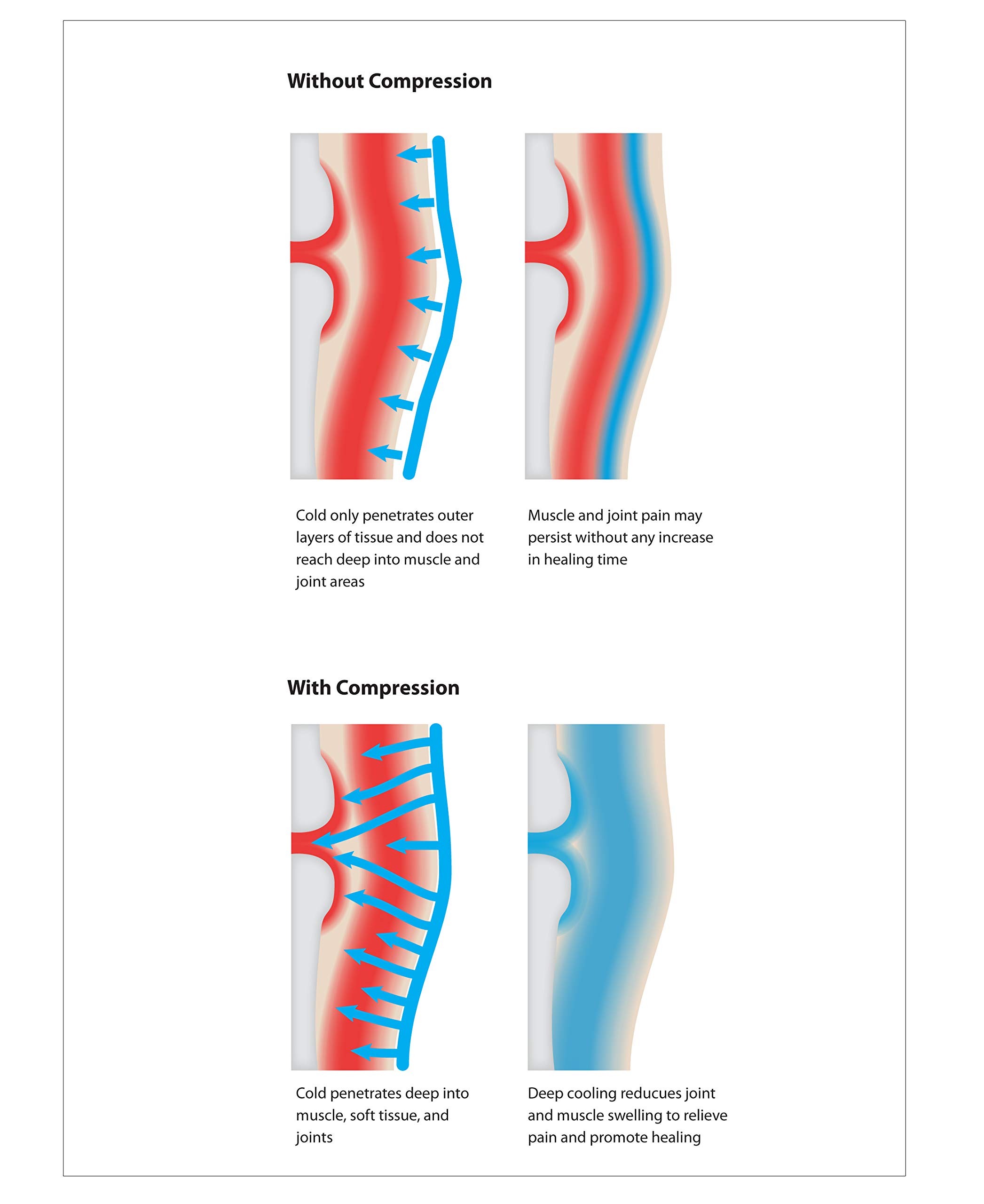 Best Cold Compression Ankle Wrap for Sports Injuries & Recovery - Relieve Pain, Reduce Swelling - Ideal for Athletes, Runners & Post-Surgery Use
