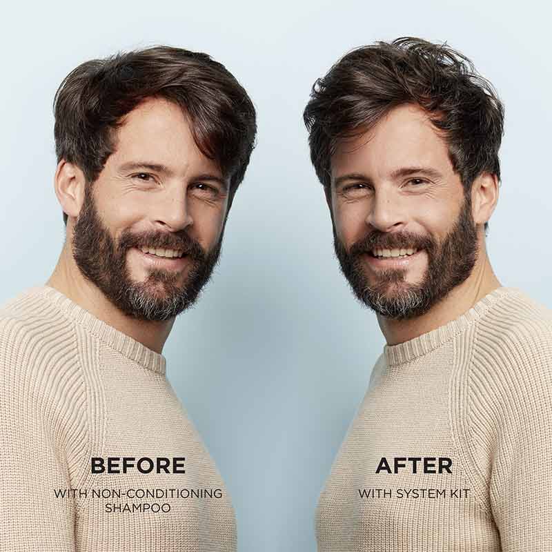 Nioxin System 1 Hair Care Kit for Thinning Hair - 3-Piece Shampoo, Conditioner & Scalp Treatment Set for Men & Women - Perfect for Daily Hair Growth Routine & Thicker Looking Hair